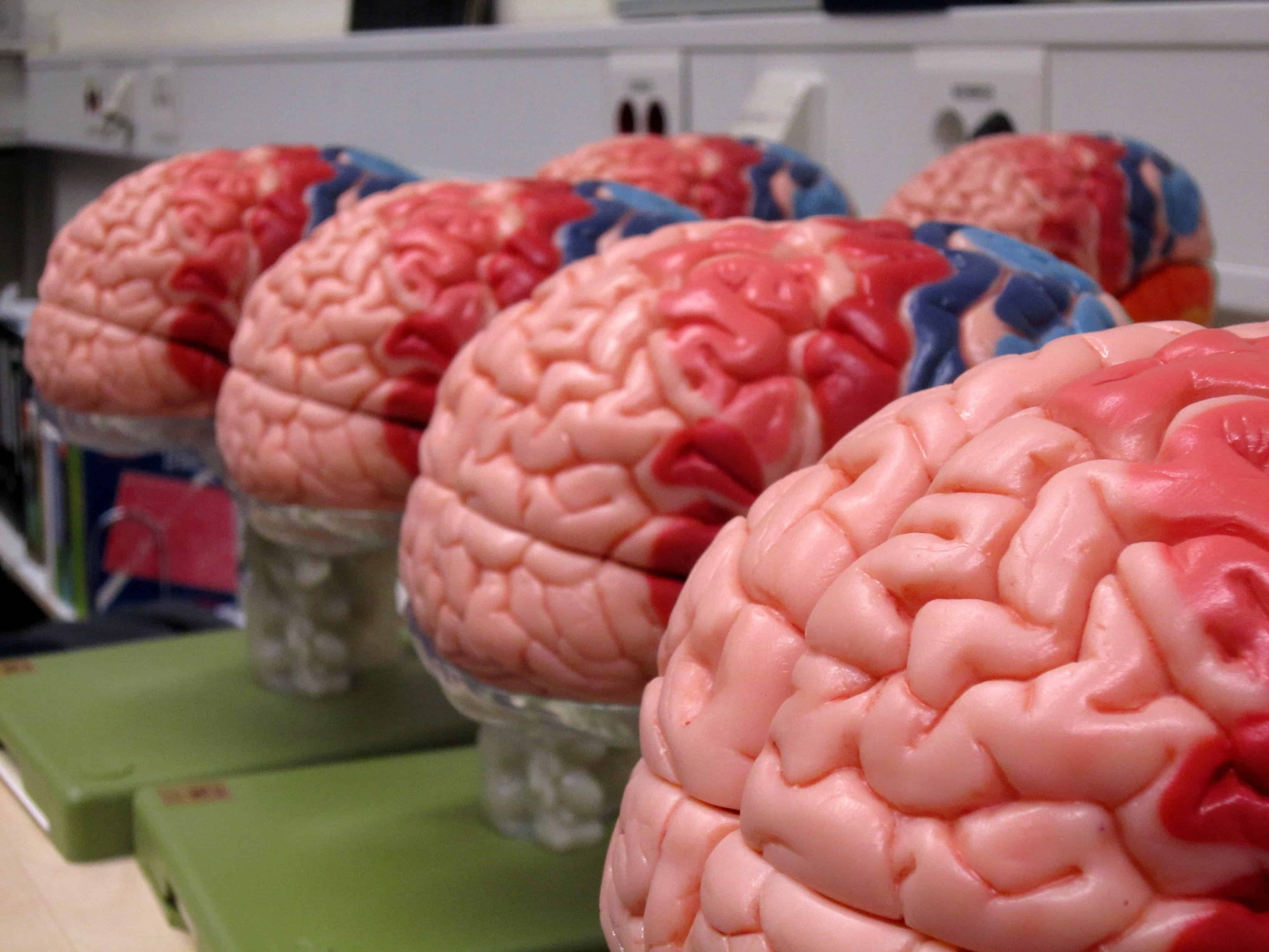 Color brain. Настоящий человеческий мозг.