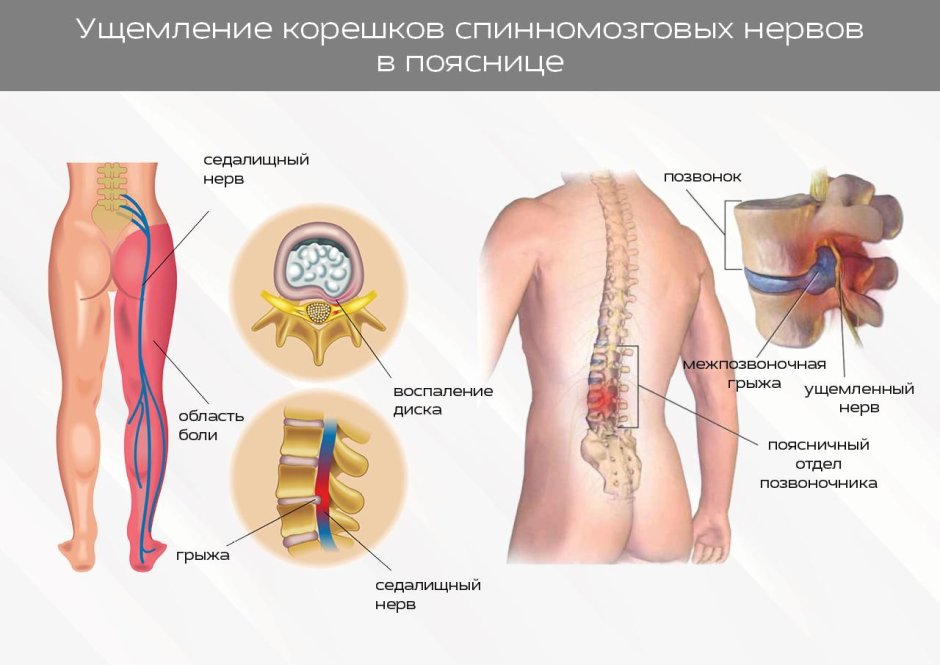 Баннер по спорту